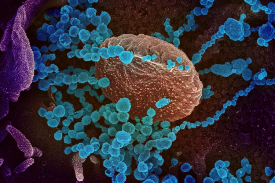 More than 5O % of Europeans to be infected with Omicron within 6-8 weeks