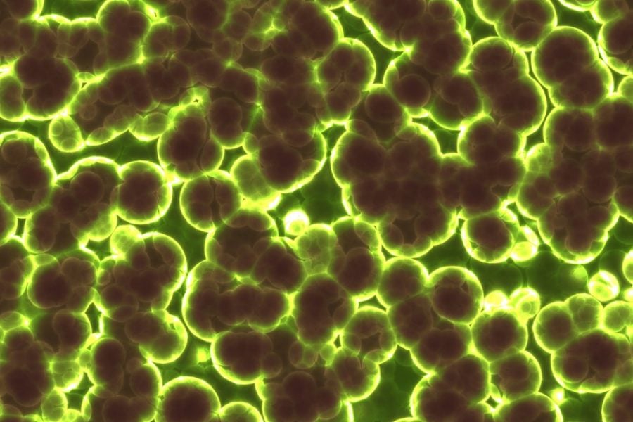 Drug-resistant bacteria found in Moroccan communities, water and food systems