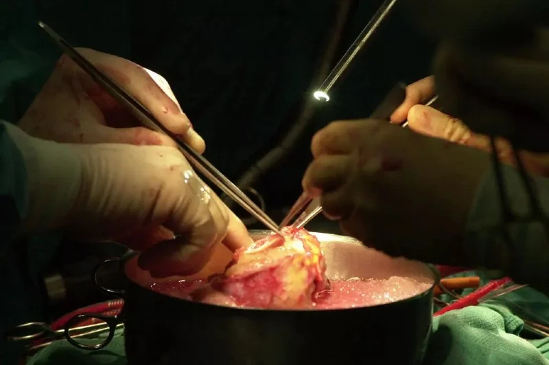 Moroccan authorities dismantle organ trafficking gang