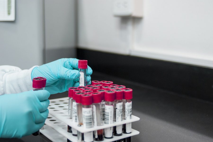 Hepatitis A outbreak in U.S. and Canada linked to strawberries
