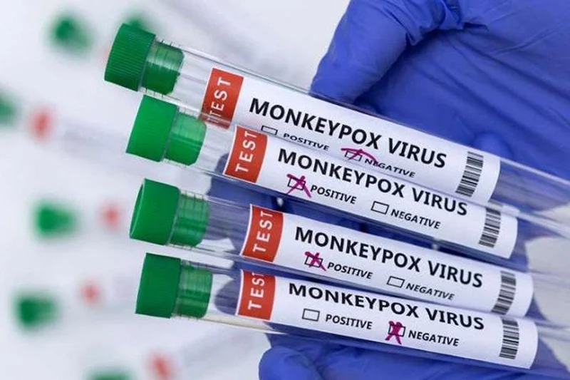 Health Ministry sources: No monkeypox cases in Morocco for months