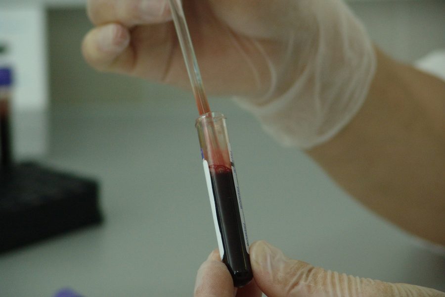 UNAIDS: AIDS can be eradicated by 2030 if government commit to goal
