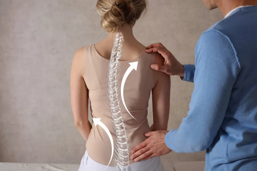 Moroccan scoliosis patients recount horros of misdiagnoses, costly treatments, and limited access to care