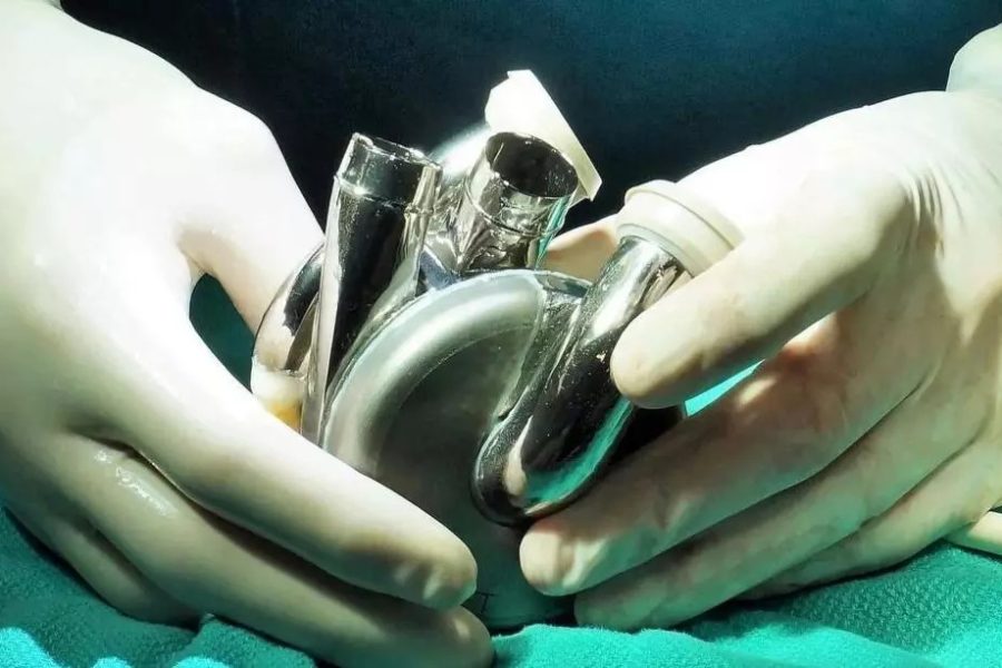 Australian man survives 105 days with artificial titanium heart
