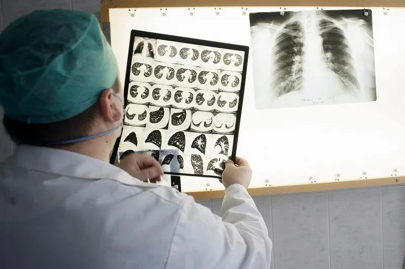 Experts: Unpasteurized milk not main source of tuberculosis risk