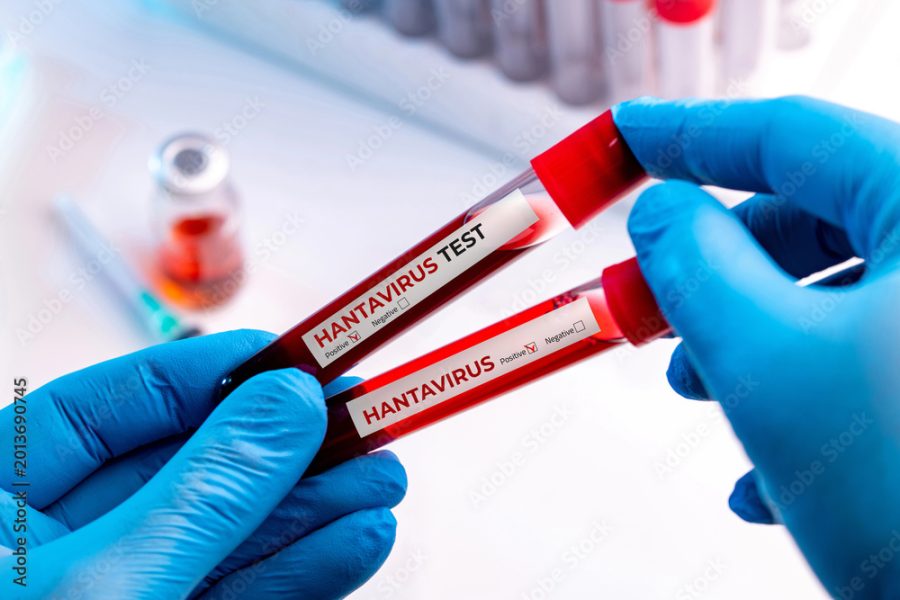 Hantavirus outbreak: Why this is not the new COVID-19 pandemic